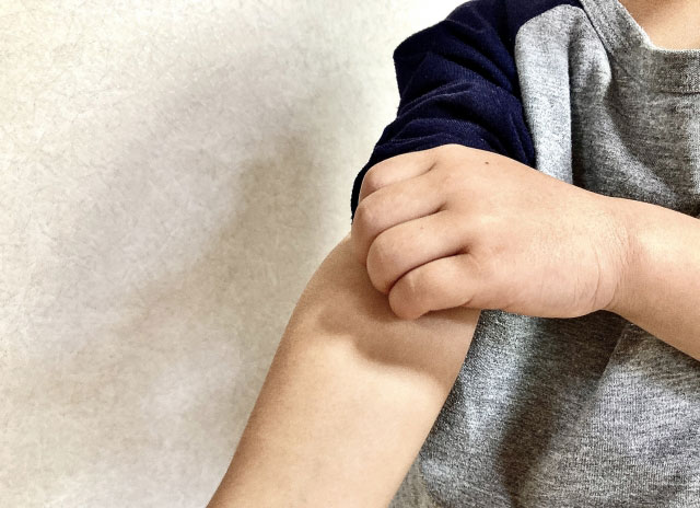 皮膚科イメージ