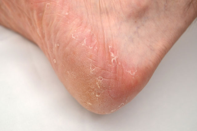 皮膚科イメージ